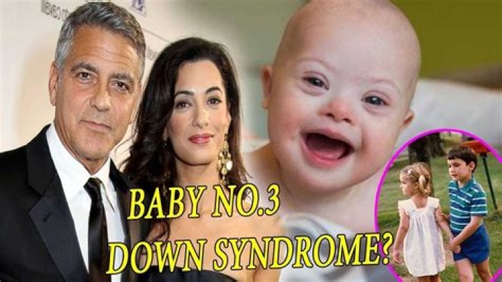 George Clooney's Twins: Understanding Down Syndrome and Parenting Challenges