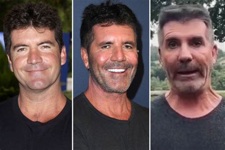 Is Simon Cowell's Son Disabled? Understanding the Facts and Myths