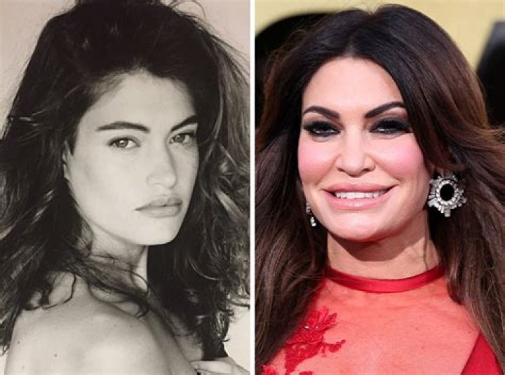 Kimberly Guilfoyle Before and After Photos: A Comprehensive Analysis of Her Transformation