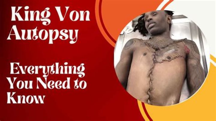 King Von Autopsy Pics: Exploring the Controversy and Impact of His Untimely Death