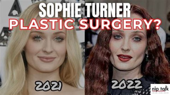 Sophie Rain Before Surgery: A Detailed Exploration of Her Journey